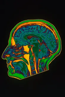 Normal Brain Structure Prints: Brain MRI