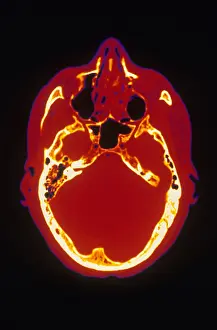 Computed Tomography Scans Prints: Head, CT Scan