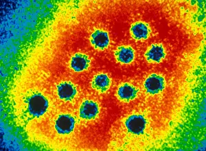 Microscopic Images Prints: Hepatitis A Virus (TEM)