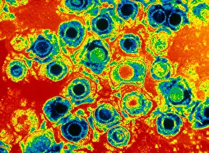 Herpes Simplex Virus Print (TEM) - Colored Transmission Electron Micrograph