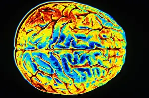 Nervous System Diagrams Prints: Human Brain