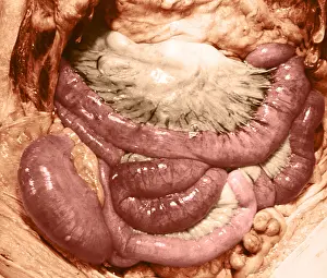 Human Anatomy Prints: Intestines