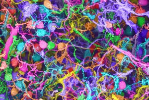 SEM Print of Human Brain Cells at 1400x Magnification