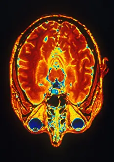 Brain Color Enhanced Cross Sectional MRI Scan Print
