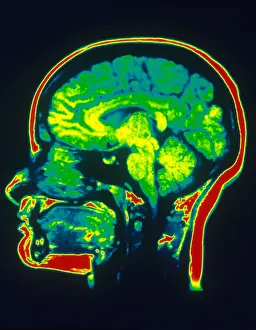 Normal Brain Anatomy Prints: MRI of Brain