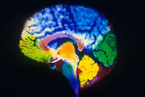 Normal Brain Anatomy Prints: MRI of Brain