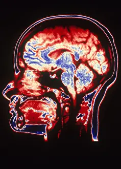 Normal Brain Anatomy Prints: MRI of Head