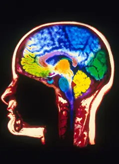 Magnetic Resonance Imaging (MRI) Prints: MRI of Head