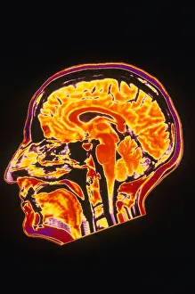 Normal Brain Anatomy Prints: MRI of Head