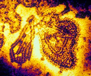 Medical Microbiology Prints: Mumps Virus (TEM)