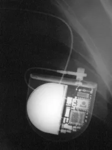 Medical Imaging Technology Prints: Pacemaker