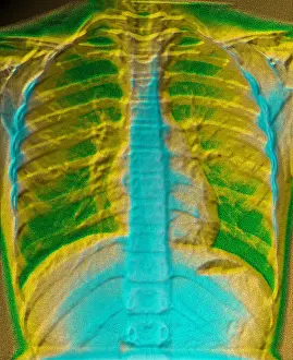 Medical Computer Graphics Prints: A normal chest X-ray