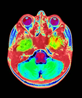 Normal Brain Anatomy Prints: Normal MRI