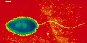 Electron Microscopy Images Prints: Pseudomonas cepacea