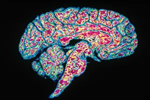 Human Nervous System Prints: Sagittal Section of Brain