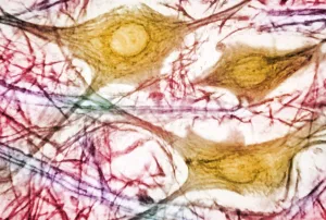 Spinal Cord Motor Cells Print, Colorized Light Micrograph