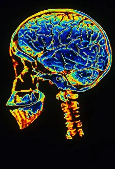 Nervous System Diagrams Prints: Skull With Brain