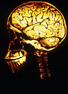 Human Brain Illustration Prints: Skull With Brain