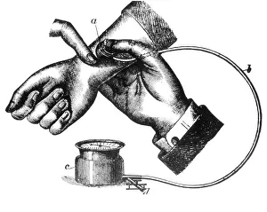 Blood Pressure Measurement Prints: Sphygmomanometer, 1883