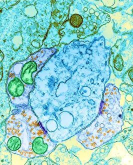 Transmission Electron Microscopy Prints: Synapse, TEM