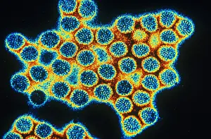 Electron Microscopy Images Prints: TEM of Rotavirus