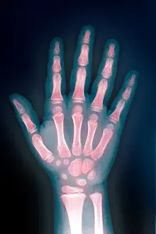 Child Development Stages Prints: X-ray of hand